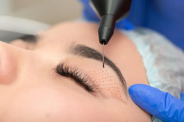 Plexr Plasma Eye Lift